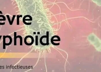 Fièvre typhoïde : 5 astuces pour se protéger au quotidien